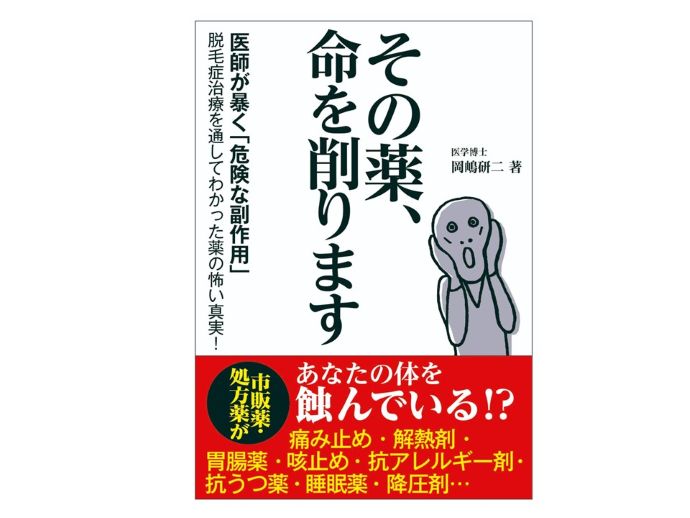 円形脱毛症　病院